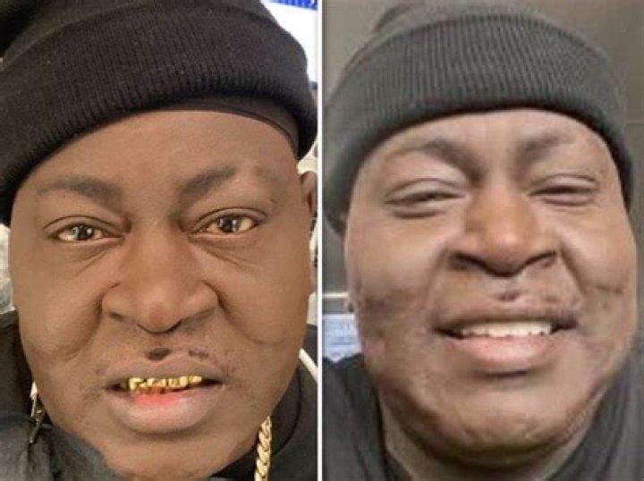 What happened to Trick Daddy's face? The king of Love & Hip Hop Miami